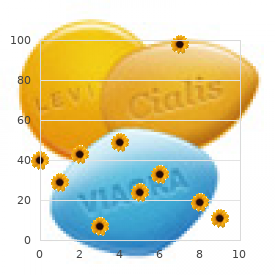 Syncamptodactyly scoliosis
