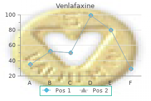 generic 150mg venlafaxine with mastercard