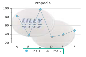 cheap propecia 1 mg with mastercard