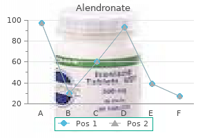 purchase alendronate 70 mg without prescription