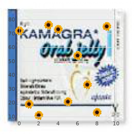 Oral facial digital syndrome type 4