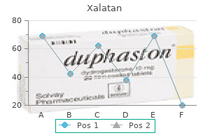 buy xalatan amex