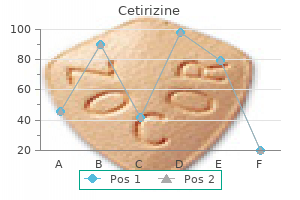 purchase generic cetirizine line
