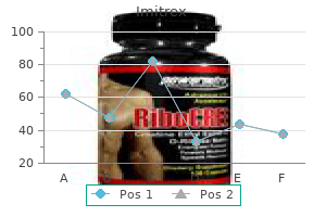 imitrex 50 mg