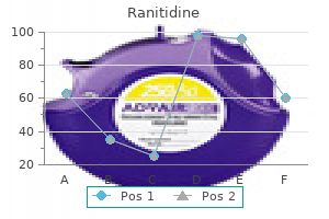 discount ranitidine 150 mg on-line