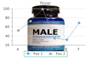 buy tricor with american express