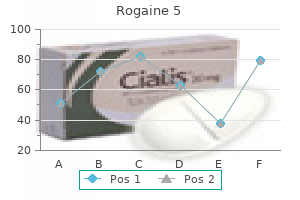 cheap rogaine 5 online