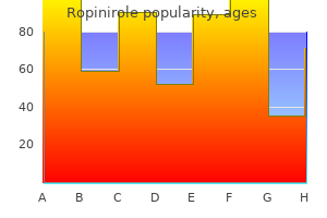 buy ropinirole with mastercard