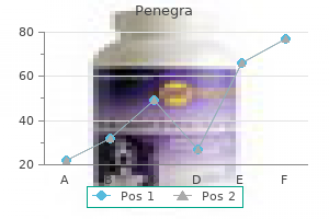 discount penegra 50mg without a prescription