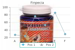 1 mg finpecia overnight delivery