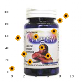 Brachymesophalangy type 2