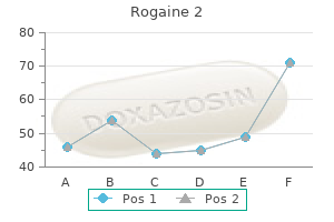 generic rogaine 2 60ml fast delivery