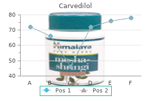 order genuine carvedilol online