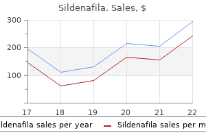 cheap sildenafila 50 mg overnight delivery